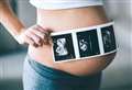 Trust to charge parents for baby scan photos