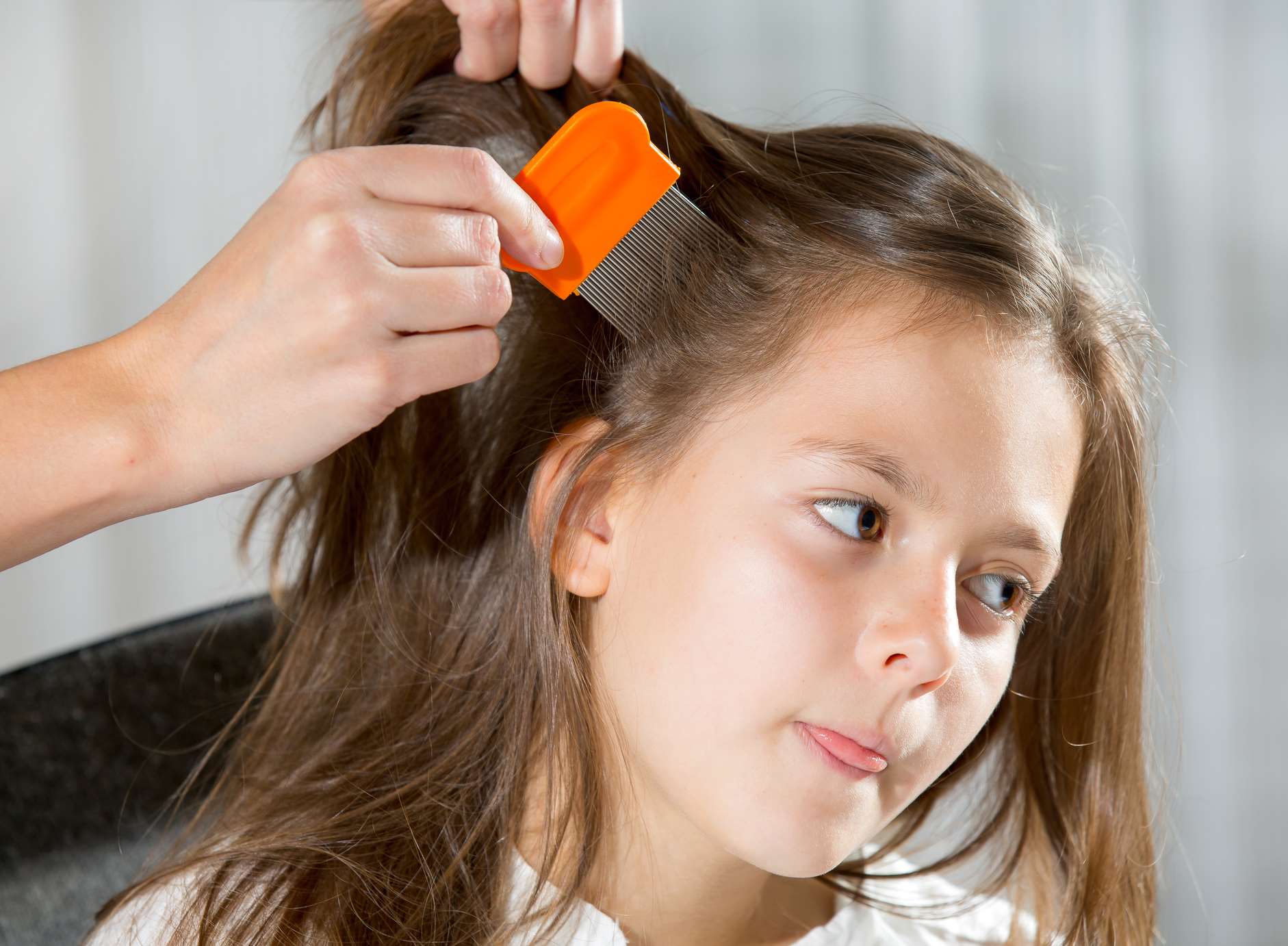 Nits are the empty egg cases attached to hair that head lice hatch from