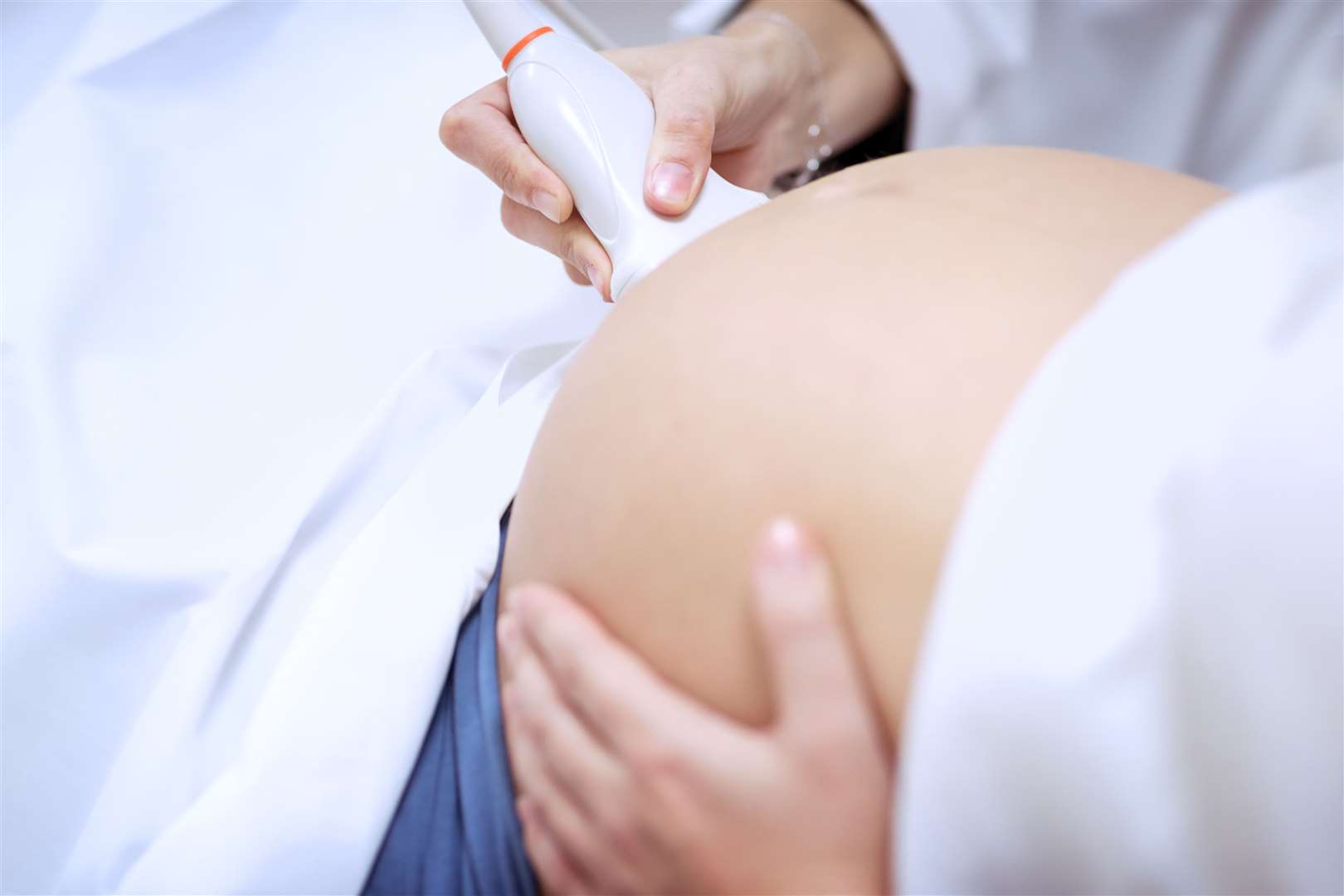 Pregnant women who catch the virus are expected to be offered an additional scan once they have recovered