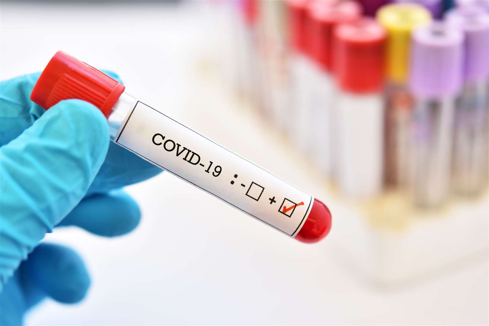 A positive covid test means that you will need to isolate, according to the law. Picture: iStock