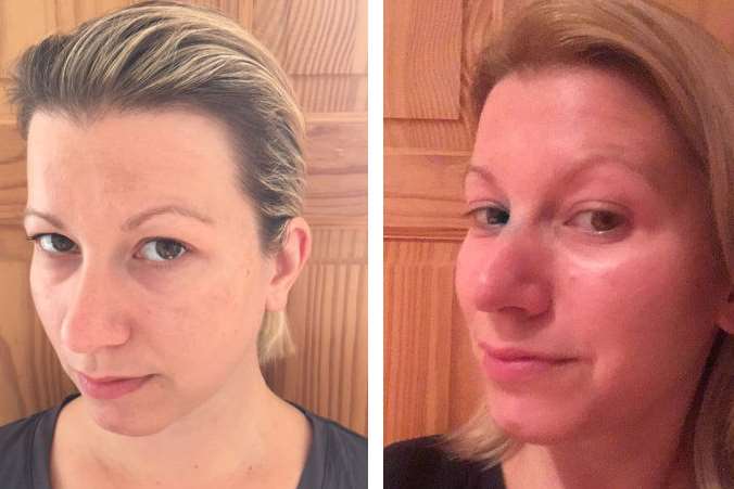 Abi Jackson's 'before', left, and 'after' shots after using Avon ANEW Reversalist Infinite Effects Night Treatment for one month