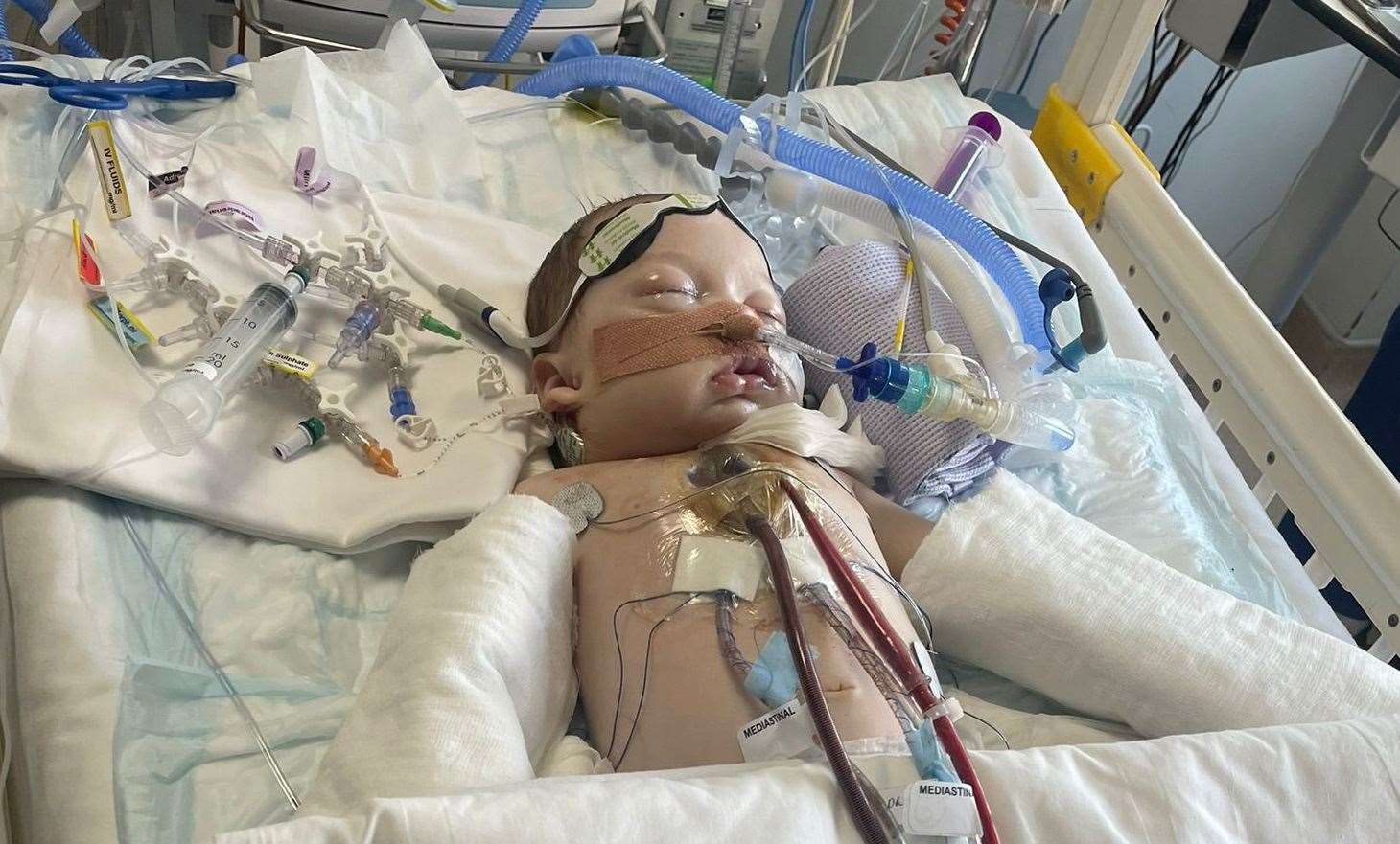Leila the day after open heart surgery