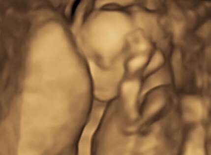 My baby scan