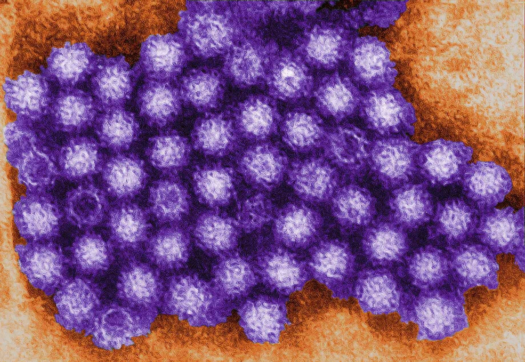 Norovirus causes sickness and is easily passed between people