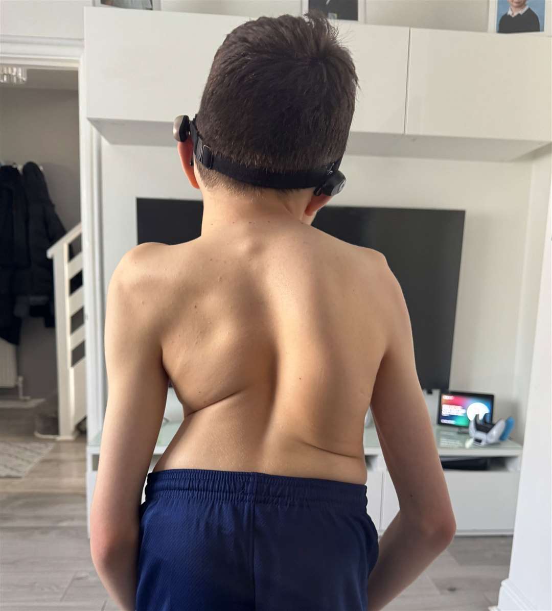 Harley's back looks like “a tree bent by years of wind”