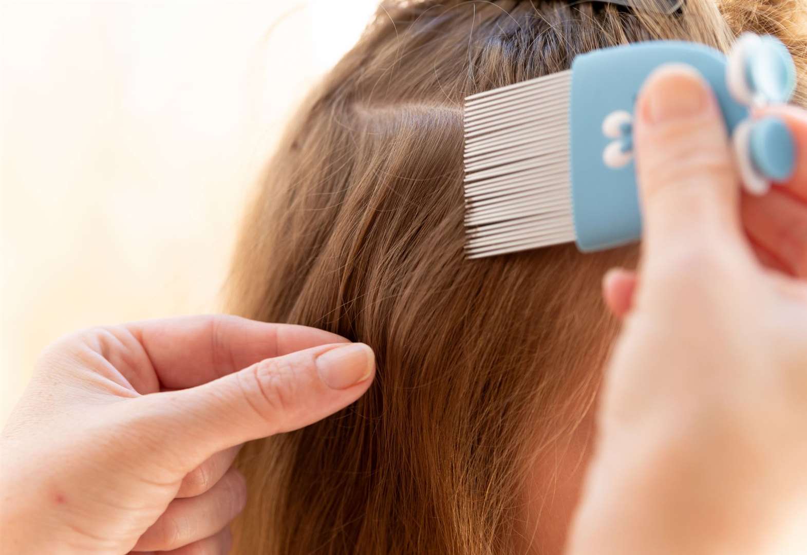 NHS England says it has noticed a rise in people needing help with head lice since the start of September. Image: iStock/Jose Luis Castro.